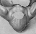 Fig. 6. Carnegie Embryo 2023, 15 mm, female. X 14.