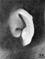 Fig. 35. Embryo No. 2170, 50 mm.