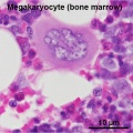 Megakaryocyte
