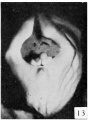 Fig. 13. Carnegie Embryo No. 684