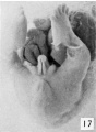 Fig. 17. Carnegie Embryo No.879c