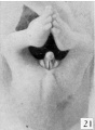 Fig. 21. Carnegie Embryo No. 950, Male