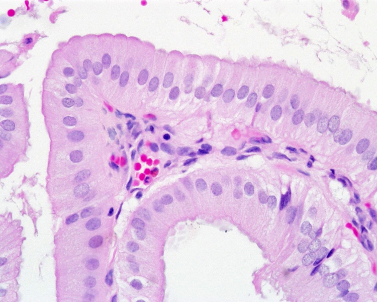 File:Gall bladder histology 004.jpg