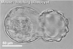 Mouse hatching blastocyst