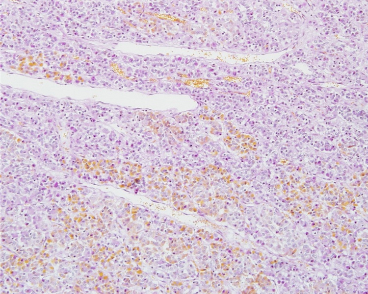 File:Pituitary histology 006.jpg