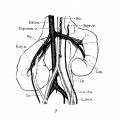 Fig. 7 Unrotated, right ectopic kidney