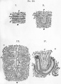 Fig. 118. Histology of the placenta. diagrammatic representations of the minute structure of the placenta. (From Turner.)
