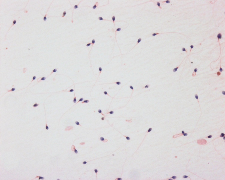 File:Spermatozoa histology 002.jpg
