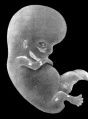 Fig 1 Embryo No. 333