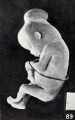Fig. 89. Normal fetus with hernia of mid-brain. No. 1690. X6.75.