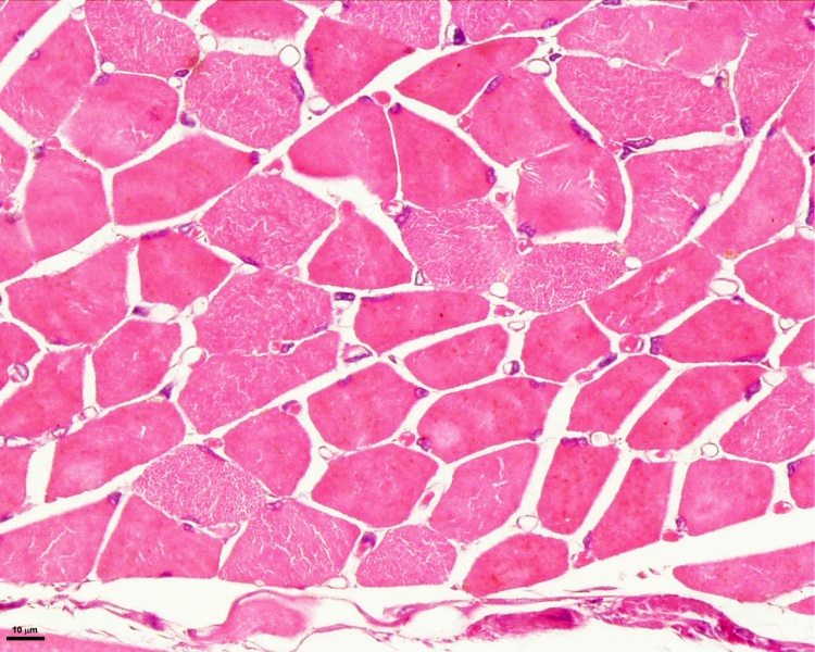 File:Skeletal muscle histology 003.jpg