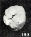 Figs. 193. Cyemata illustrating changes in form due to maceration. No. 208 (X2).