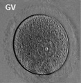 Germinal vesicle oocyte - existing website image, relevant to project.