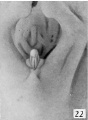 Fig. 22. Carnegie Embryo 1358h