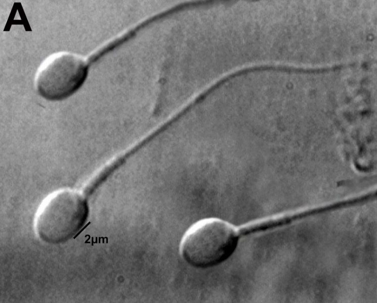 File:Human-spermatozoa 01a.jpg