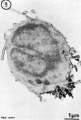 B lymphocyte 2 TEM