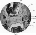 Fig. 7. Coronal section of a 19 mm Embryo