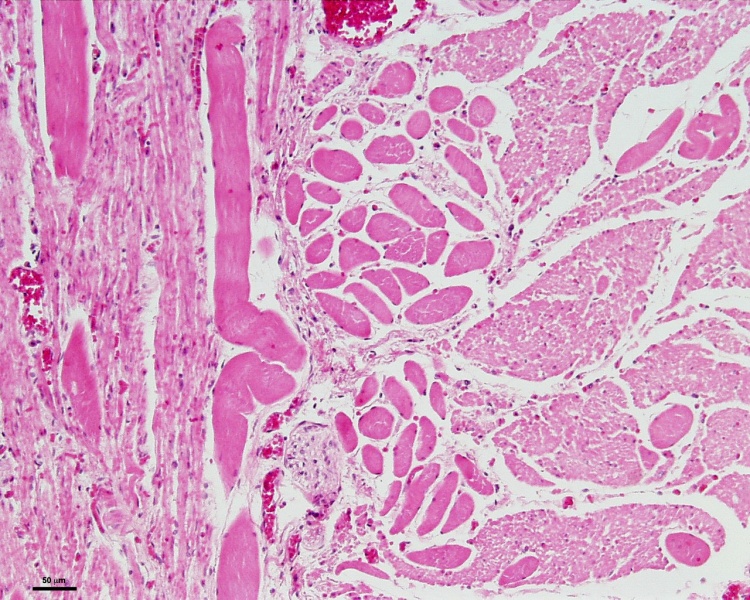 File:Smooth muscle histology 006.jpg