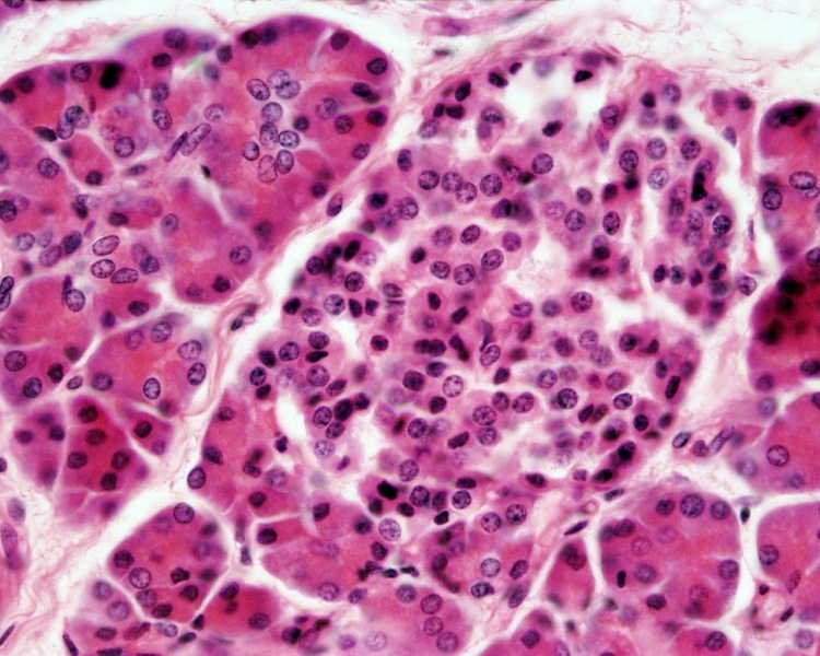File:Pancreas histology 103.jpg