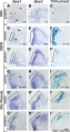 Mouse otic placode Spry1, Spry2, and Wnt
