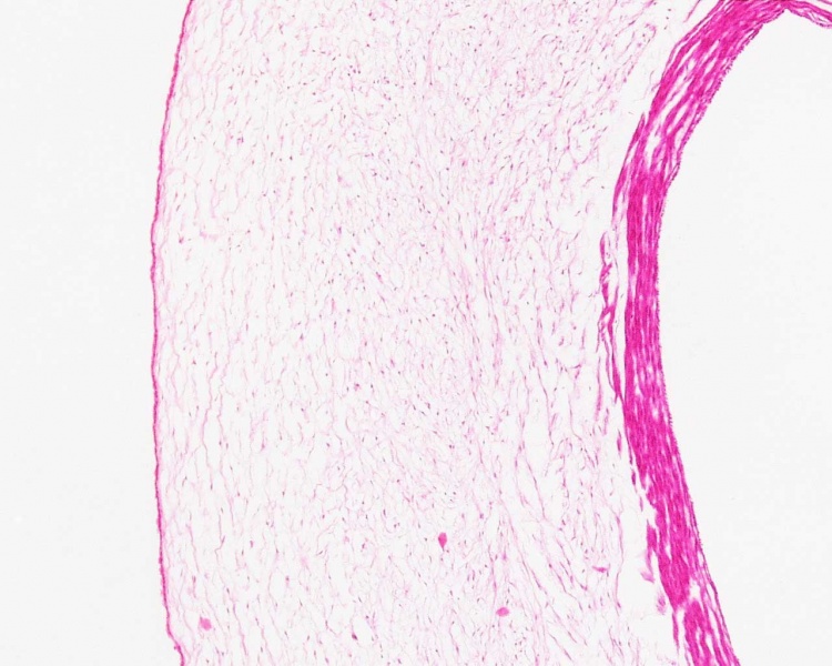 File:Placenta histology 002.jpg