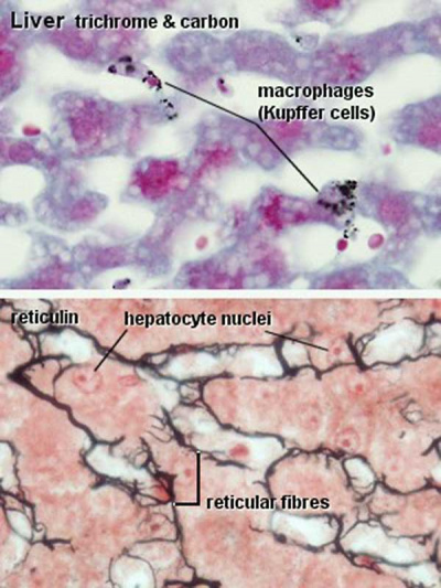 Liver- Kupffer cell and reticular fibre.jpg