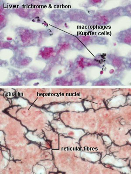 File:Liver- Kupffer cell and reticular fibre.jpg