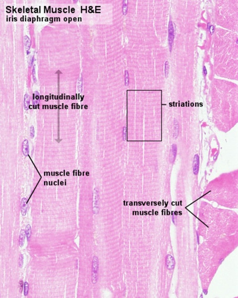 File:Skeletal muscle histology 012.jpg