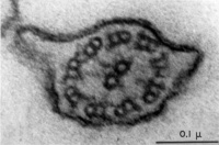 Spermatozoa tail EM01.jpg