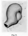 Fig. 10. Shows secondary optic vesicle wall and C shows choroidal fissure at bottom of foetal eye
