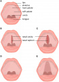 cleft palate Z5039628 Copyright and student template included. Image relevant to project, description from original figure legend. Reference not included correctly as a citation required by the journal for reuse Citation - <pubmed>26973535</pubmed>