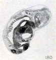 Fig. 180. Fetus showing continuity of epidermis across the mouth, with obliteration of the labial slit. No. 885. X 4.5.