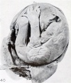 Fig. 40. Macerated, rolled-up, older fetus. No. 1041. X0.75.