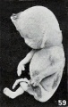 Figs. 52-63. Illustrating the absence of fundamental differences between the group of fetus compressus and grade 3 of the normal specimens. No. 1513 (fig. 59) pathological. X0.58.
