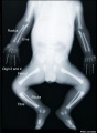 normal x-ray