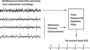 Fetal Electrocardiogram Enhancement