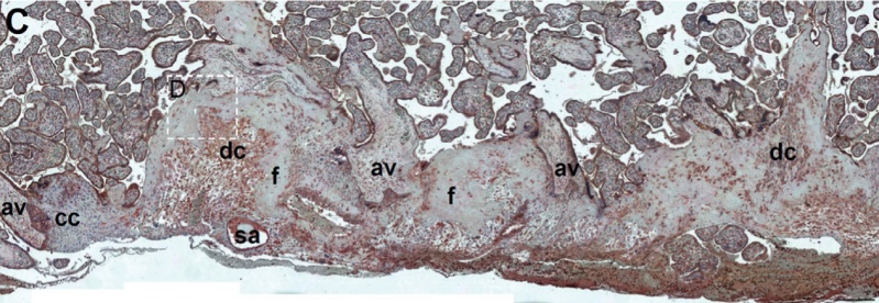File:Placenta histology 007.jpg
