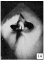 Fig. 14. Carnegie Embryo No. 194
