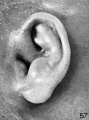 Fig. 57. Embryo No. 1702 150 mm