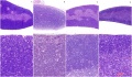 histopathology thymus hyperplasia and thymoma Z3418837 Figure relates to abnormal thymus topic and contains reference, copyright and student template. This is a good image of abnormal thymus, but you do not identify species or how this relates to fetal development.