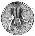 Fig. 4. Mesonephric ridge embryo H 323.