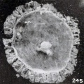 Fig. 245. Cross-section view of an entire normal vesicle with cyema and adnexa. No. 2053. X3.