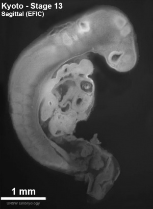 EFIC sagittal image of embryo Carnegie stage 13