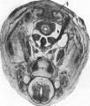 Fig. 5. Transverse section through caudal region of a 20 mm embryo H 304