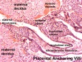 Placenta anchoring villi and maternal decidua
