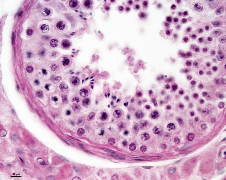 File:Smooth muscle histology 007.jpg