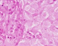 theca and granulosa lutein cells
