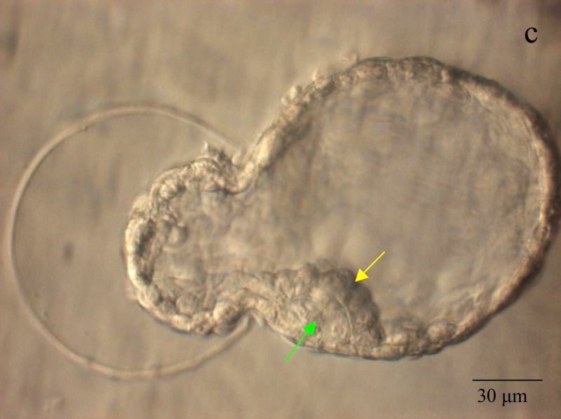 File:Mouse blastocyst hatching 01.jpg