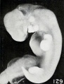 Fig. 129. A somewhat macerated normal embryo from a case of early hydatiform degeneration. No. 2099. X6.