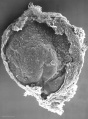 Embryonic disc (SEM)